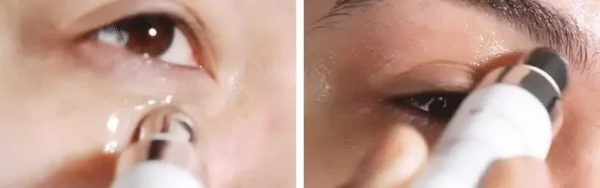 HYALURONIC CAFFEINE DEPUFF EYE GEL